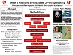 Effect of Reducing Brain Lactate Levels by Blocking Glutamate Receptors in Panic Disorder Patients by Tim Bennett