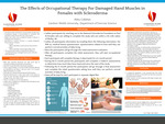 The Effects of Occupational Therapy For Damaged Hand Muscles in Females with Scleroderma